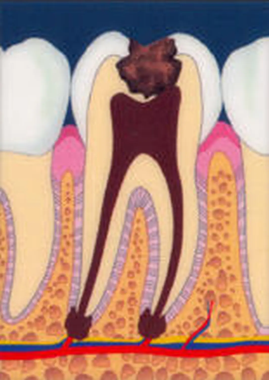 Oralchirurgie Zahnarztpraxis