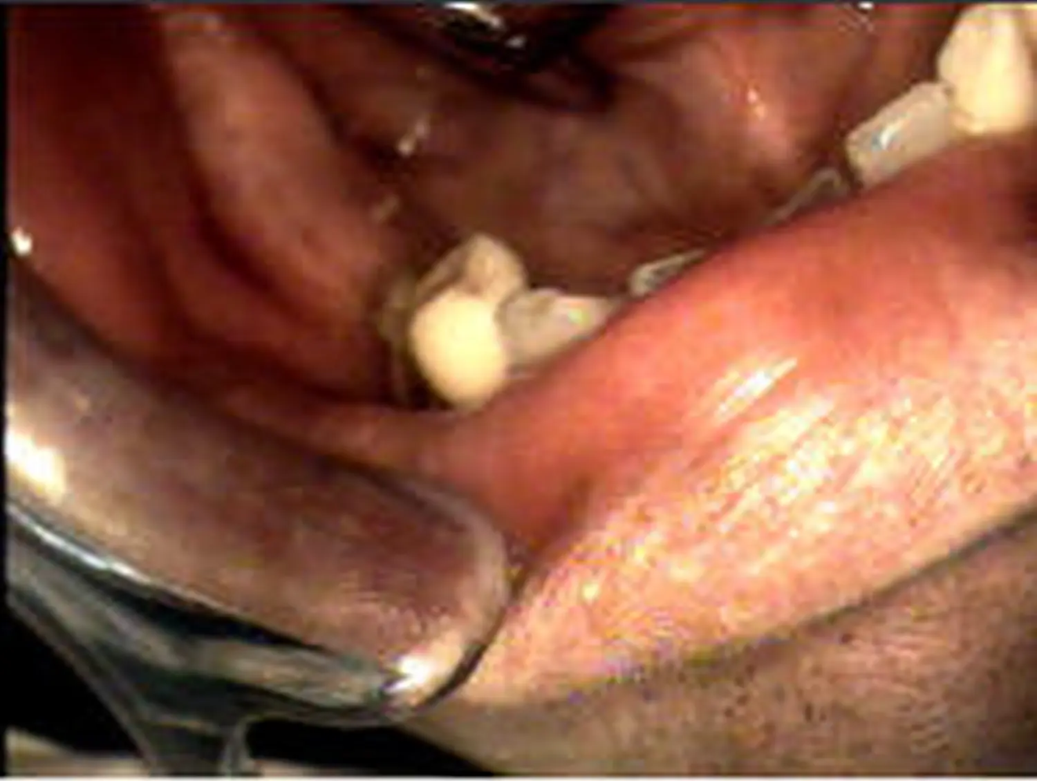 Oralchirurgie Zahnarztpraxis